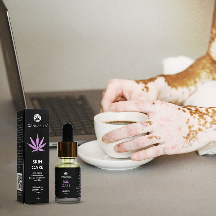 CBD and Psoriasis: A Dermatological Revolution?