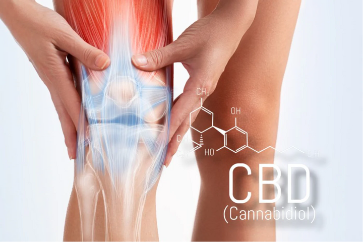 What Is Psoriactic Arthritis: How Can Cannabinoids Help?